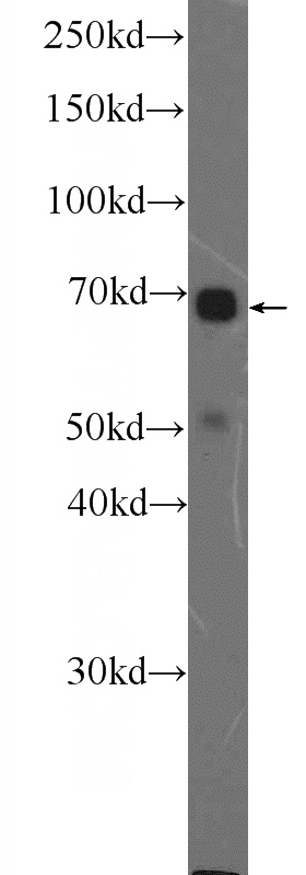 SKOV-3 cells were subjected to SDS PAGE followed by western blot with Catalog No:112436(MAPK7 Antibody) at dilution of 1:600