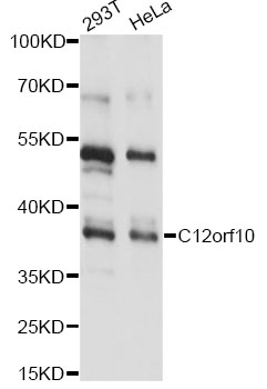 Western blot - C12orf10 Polyclonal Antibody 