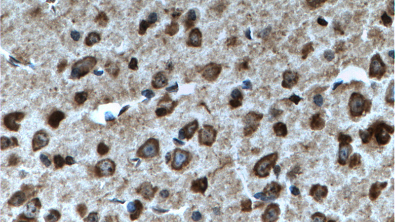 Immunohistochemistry of paraffin-embedded mouse brain tissue slide using Catalog No:109647(CXCR7-Specific Antibody) at dilution of 1:100 (under 40x lens). heat mediated antigen retrieved with Tris-EDTA buffer(pH9).