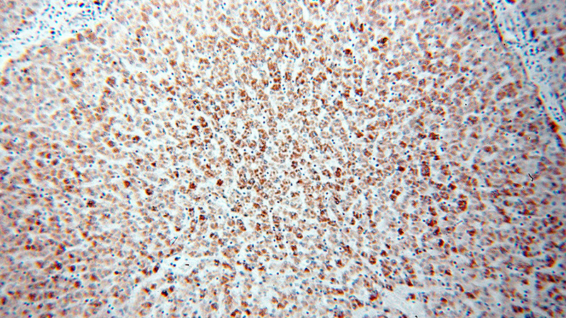 Immunohistochemical of paraffin-embedded human liver using Catalog No:107949(AKT2 antibody) at dilution of 1:100 (under 10x lens)