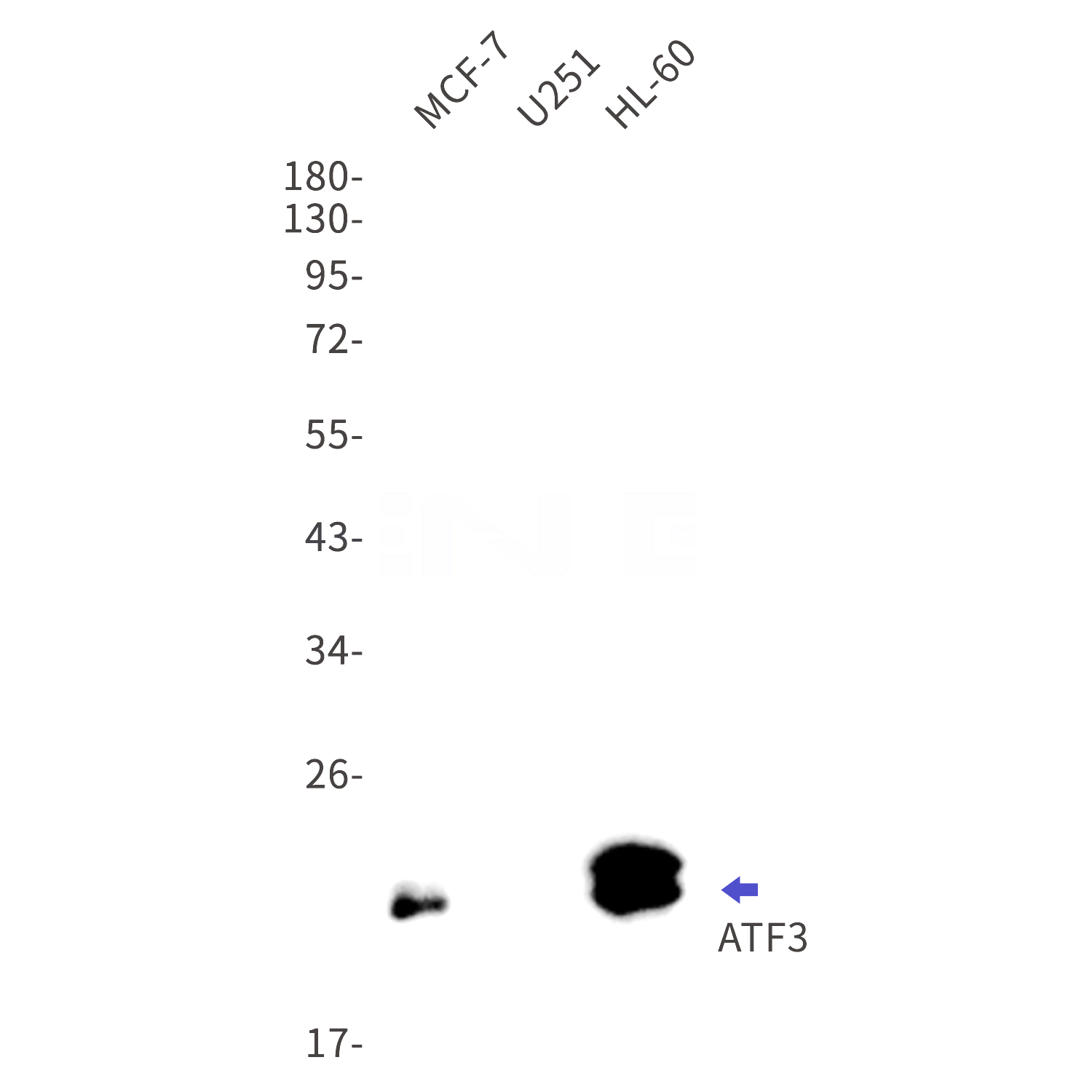 Western blot detection of ATF3 in MCF-7,U251,HL-60 cell lysates using ATF3 Rabbit mAb(1:1000 diluted).Predicted band size:21kDa.Observed band size:21kDa.
