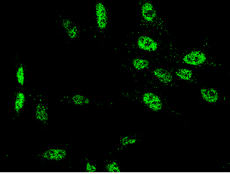 Human SIRT6 Immunofluorescence(IF) 15161