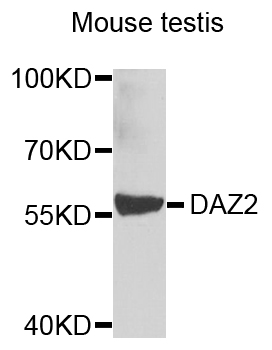 Western blot - DAZ2 Polyclonal Antibody 
