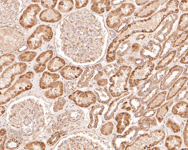 Fig3:; Immunohistochemical analysis of paraffin-embedded human kidney tissue using anti-GSDMC antibody. The section was pre-treated using heat mediated antigen retrieval with Tris-EDTA buffer (pH 8.0-8.4) for 20 minutes.The tissues were blocked in 5% BSA for 30 minutes at room temperature, washed with ddH; 2; O and PBS, and then probed with the primary antibody ( 1/200) for 30 minutes at room temperature. The detection was performed using an HRP conjugated compact polymer system. DAB was used as the chromogen. Tissues were counterstained with hematoxylin and mounted with DPX.