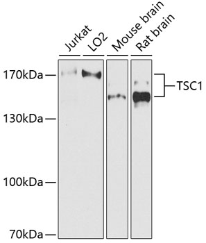 Western blot - TSC1 Polyclonal Antibody 