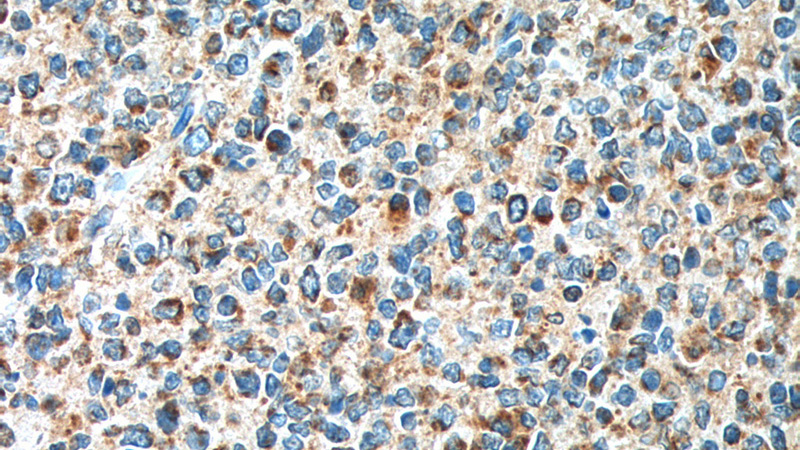 Immunohistochemistry of paraffin-embedded human tonsillitis tissue slide using Catalog No:111133(GPR65 Antibody) at dilution of 1:200 (under 40x lens). heat mediated antigen retrieved with Tris-EDTA buffer(pH9).