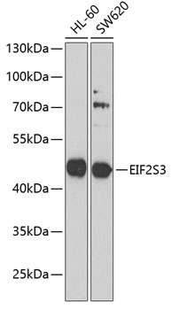 Western blot - EIF2S3 Polyclonal Antibody 