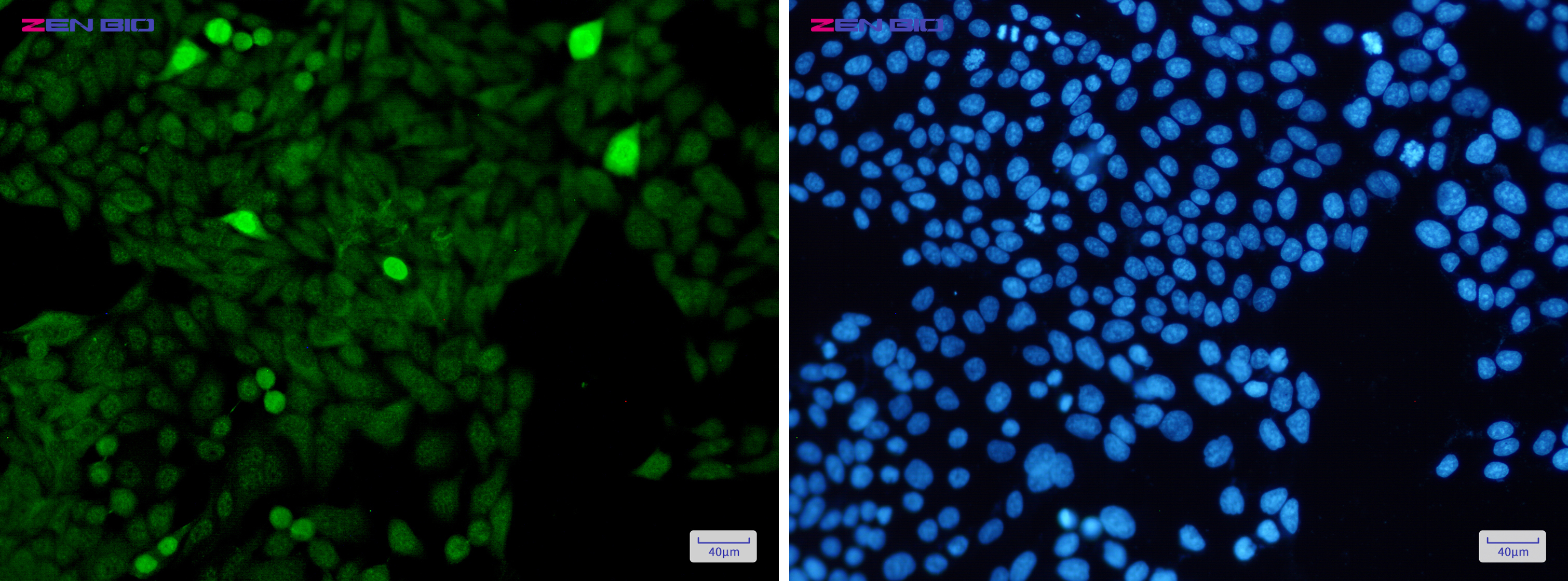 Immunocytochemistry of Histone H3 (Phospho-Ser28)(green) in Hela cells using Histone H3 (Phospho-Ser28) Rabbit pAb at dilution 1/50, and DAPI(blue)