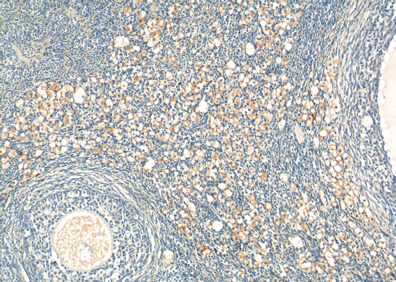 Immunohistochemistry of paraffin-embedded human ovary tissue slide using Catalog No:116019(TGFB1 Antibody) at dilution of 1:200 (under 10x lens).