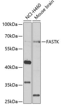 Western blot - FASTK Polyclonal Antibody 