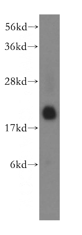 human brain tissue were subjected to SDS PAGE followed by western blot with Catalog No:114656(RHEB antibody) at dilution of 1:500