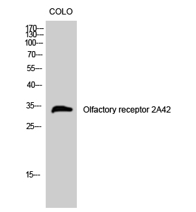Fig1:; Western Blot analysis of COLO cells using Olfactory receptor 2A42 Polyclonal Antibody