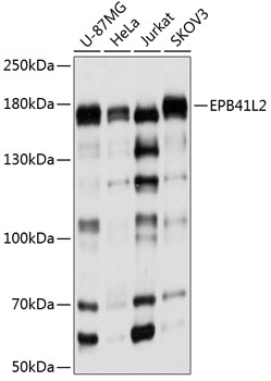Western blot - EPB41L2 Polyclonal Antibody 
