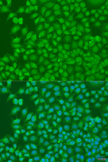 Immunofluorescence - BIRC3 Polyclonal Antibody 