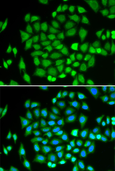 Immunofluorescence - AKR7A2 Polyclonal Antibody 