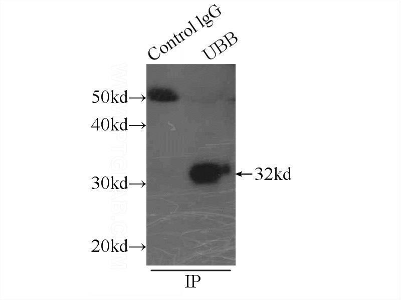 IP Result of anti-ubiquitin (IP:Catalog No:116649, 3ug; Detection:Catalog No:116649 1:300) with mouse liver tissue lysate 5000ug.