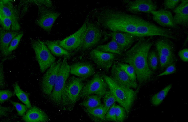 Immunofluorescent analysis of A549 cells using Catalog No:111830(IREB2 Antibody) at dilution of 1:50 and Alexa Fluor 488-congugated AffiniPure Goat Anti-Rabbit IgG(H+L)