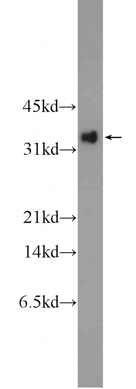 Recombinant proteins of SMARCA4 which contains GP repeat sequence were subjected to SDS PAGE followed by western blot with Catalog No:111052 (GP repeat Antibody) at dilution of 1:1000