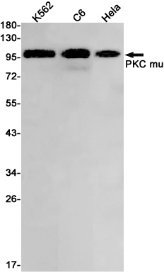 Western blot detection of PKC mu in K562,C6,Hela cell lysates using PKC mu Rabbit pAb(1:1000 diluted).Predicted band size:102kDa.Observed band size:102kDa.