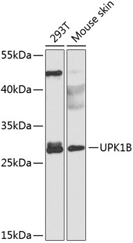 Western blot - UPK1B Polyclonal Antibody 