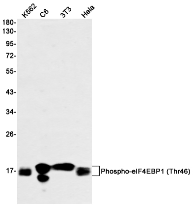 Western blot detection of Phospho-eIF4EBP1 (Thr46) in K562,C6,3T3,Hela cell lysates using Phospho-eIF4EBP1 (Thr46) Rabbit mAb(1:1000 diluted).Predicted band size:13kDa.Observed band size: 15-20kDa.