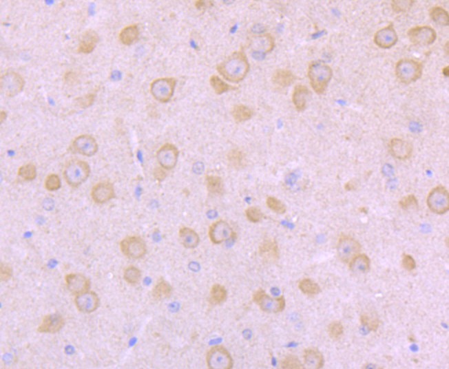 Fig2: Immunohistochemical analysis of paraffin-embedded mouse brain tissue using anti-NaV1.8 antibody. Counter stained with hematoxylin.