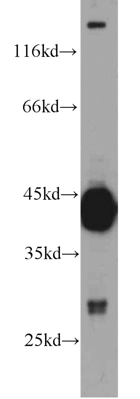 mouse kidney tissue were subjected to SDS PAGE followed by western blot with Catalog No:114704(RIMBP2 antibody) at dilution of 1:1000