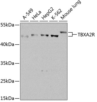 Western blot - TBXA2R Polyclonal Antibody 