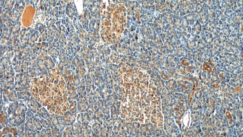 Immunohistochemistry of paraffin-embedded human pancreas tissue slide using Catalog No:109556(CRH Antibody) at dilution of 1:200 (under 10x lens).