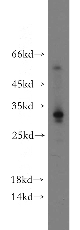 HepG2 cells were subjected to SDS PAGE followed by western blot with Catalog No:108986(CCDC70 antibody) at dilution of 1:500