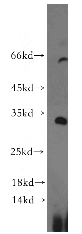 K-562 cells were subjected to SDS PAGE followed by western blot with Catalog No:112084(KLF7 antibody) at dilution of 1:300