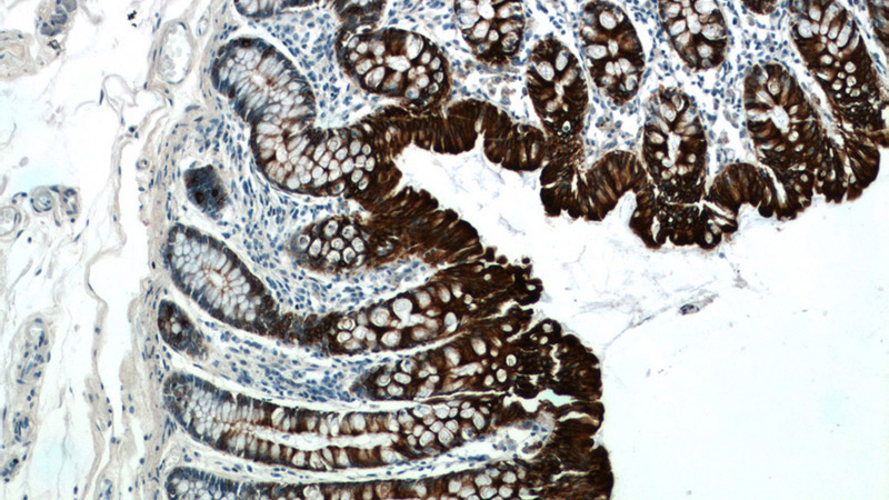 Immunohistochemistry of paraffin-embedded human colon tissue slide using Catalog No:109802(CK19 Antibody) at dilution of 1:200 (under 10x lens)