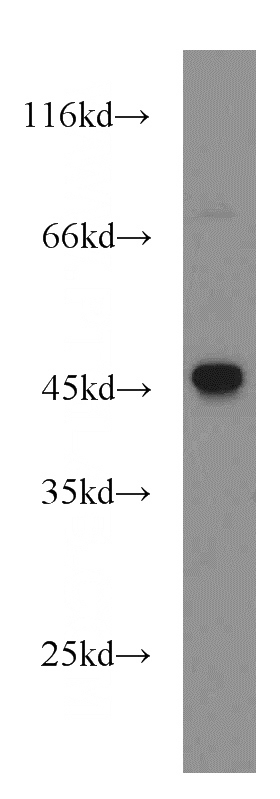 HEK-293 cells were subjected to SDS PAGE followed by western blot with Catalog No:108271(ASS1 antibody) at dilution of 1:500