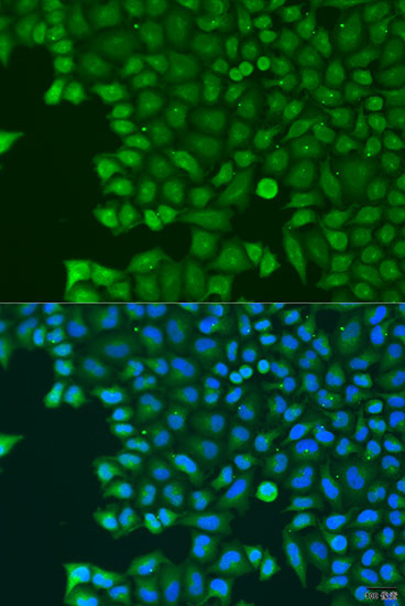 Immunofluorescence - ABCE1 Polyclonal Antibody 