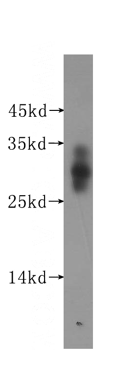 human brain tissue were subjected to SDS PAGE followed by western blot with Catalog No:107797(ADO antibody) at dilution of 1:300