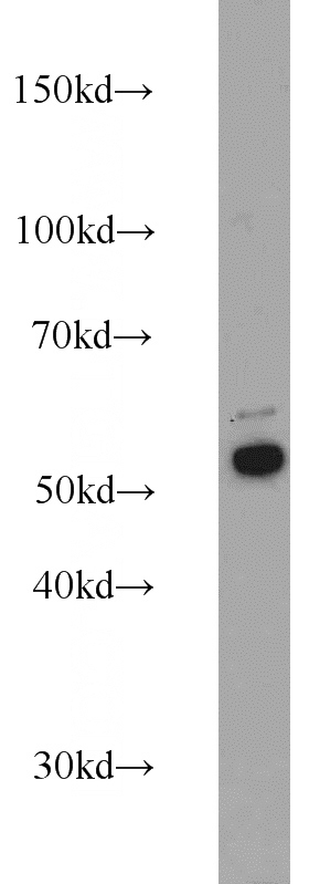 A431 cells were subjected to SDS PAGE followed by western blot with Catalog No:109809(KRT7 antibody) at dilution of 1:2000