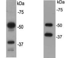 Fig1: Western blot analysis on F9 (A) and NCCIT (B) cell lysates using CD79a rabbit polyclonal antibody.