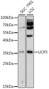Western blot - UCP3 Polyclonal Antibody 