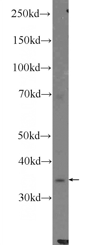 PC-3 cells were subjected to SDS PAGE followed by western blot with Catalog No:111508(HNRNPH3 Antibody) at dilution of 1:300