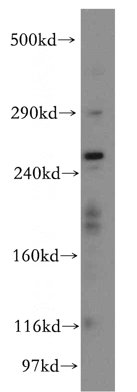 HeLa cells were subjected to SDS PAGE followed by western blot with Catalog No:114949(RYR2 antibody) at dilution of 1:500