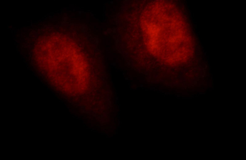 Immunofluorescent analysis of HepG2 cells, using RNF20 antibody Catalog No:114751 at 1:25 dilution and Rhodamine-labeled goat anti-rabbit IgG (red).