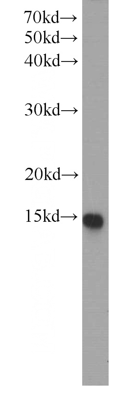 HepG2 cells were subjected to SDS PAGE followed by western blot with Catalog No:115016(SCP2 antibody) at dilution of 1:500