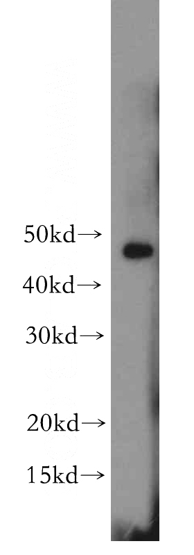 PC-3 cells were subjected to SDS PAGE followed by western blot with Catalog No:116501(TWIST1 antibody) at dilution of 1:300