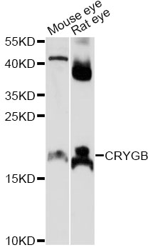 Western blot - CRYGB Polyclonal Antibody 
