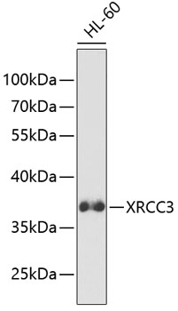Western blot - XRCC3 Polyclonal Antibody 