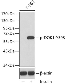 Western blot - Phospho-DOK1-Y398 pAb 