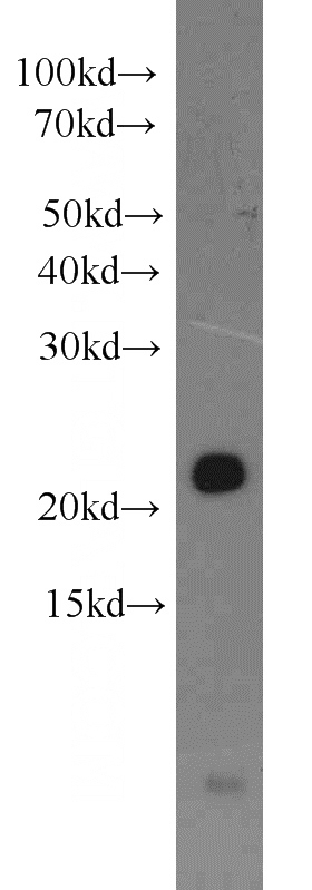 HepG2 cells were subjected to SDS PAGE followed by western blot with Catalog No:117142(BID antibody) at dilution of 1:1000