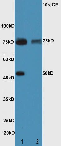 Fig1: Sample:; Kidney(Mouse) lysate at 60ug;; Liver(Mouse) lysate at 60ug;; Primary: Anti-CXorf36 at 1:300;; Secondary: HRP conjugated Goat-Anti-Rabbit IgG(bs-0295G-HRP) at 1: 5000;; Predicted band size :45 kD; Observed band size :50/75 kD