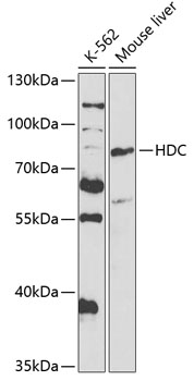 Western blot - HDC Polyclonal Antibody 