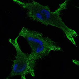 Immunofluorescence analysis of U251 cells using JUP mouse mAb (green). Blue
